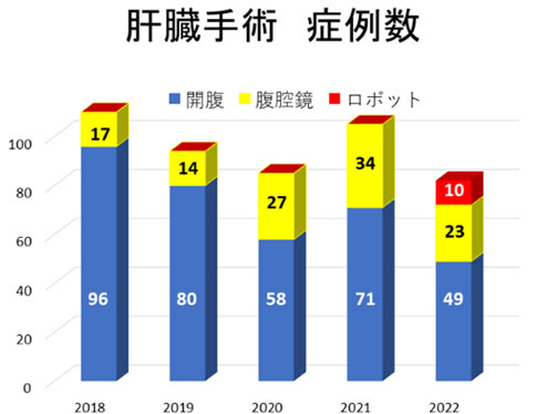 肝臓手術症例数